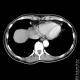 Thorax 46